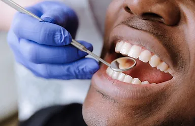 Clareamento Dental em Icaraí